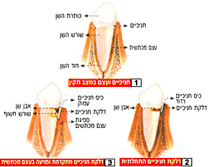 חניכיים : מצבי בריאות שונים